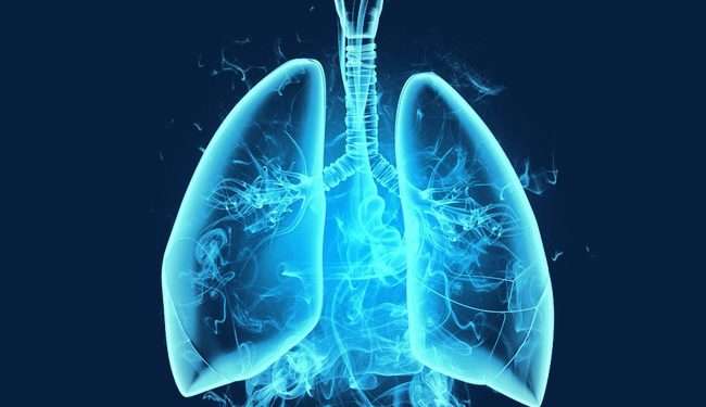 Lung drawing - Stock Image