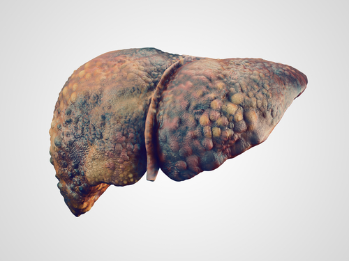 30 Reasons Why You Should Quit Smoking and Start Vaping - liver damage