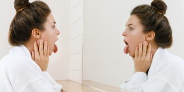What is Vaper's Tongue? What Causes Vapors Tongue? How To Get Rid of It?